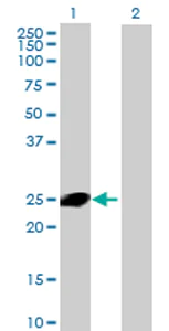 Western blot - Anti-CXorf48 antibody (AB69317)