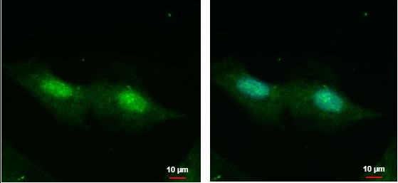Immunocytochemistry/ Immunofluorescence - Anti-CXorf57 antibody (AB228707)