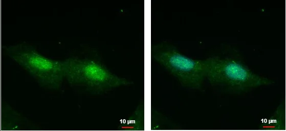 Immunocytochemistry/ Immunofluorescence - Anti-CXorf57 antibody (AB228707)