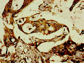 Immunohistochemistry (Formalin/PFA-fixed paraffin-embedded sections) - Anti-CXX1 antibody (AB234988)