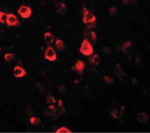 Immunocytochemistry/ Immunofluorescence - Anti-CXXC4 antibody (AB105400)