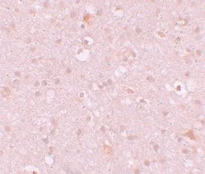 Immunohistochemistry (Formalin/PFA-fixed paraffin-embedded sections) - Anti-CXXC4 antibody (AB105400)