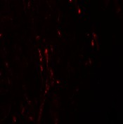 Immunocytochemistry/ Immunofluorescence - Anti-CXXC5 antibody (AB106533), expandable thumbnail
