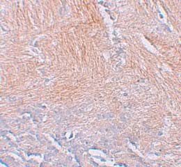 Immunohistochemistry (Formalin/PFA-fixed paraffin-embedded sections) - Anti-CXXC5 antibody (AB106533), expandable thumbnail