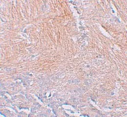Immunohistochemistry (Formalin/PFA-fixed paraffin-embedded sections) - Anti-CXXC5 antibody (AB106533)
