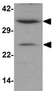 Western blot - Anti-CXXC5 antibody (AB106533)
