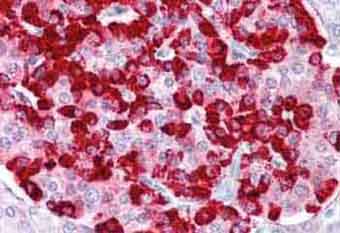 Immunohistochemistry (Formalin/PFA-fixed paraffin-embedded sections) - Anti-CXXC5 antibody (AB133191)