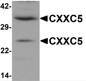 Western blot - Anti-CXXC5 antibody (AB133191)