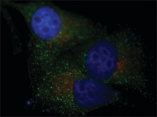 Immunocytochemistry/ Immunofluorescence - Cy3 ® Anti-LAMP1 antibody - Lysosome Marker (AB67283), expandable thumbnail