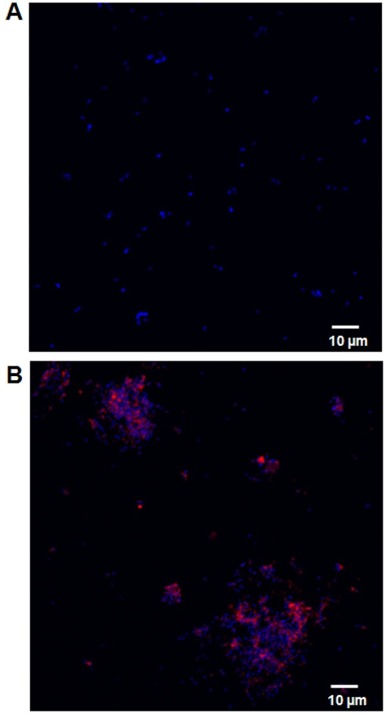 Immunocytochemistry/ Immunofluorescence - Cy5® Conjugation Kit (Fast) - Lightning-Link® (ab188288), expandable thumbnail