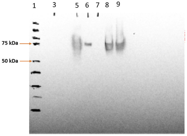 Western blot - Cy5® Conjugation Kit (Fast) - Lightning-Link® (AB188288), expandable thumbnail