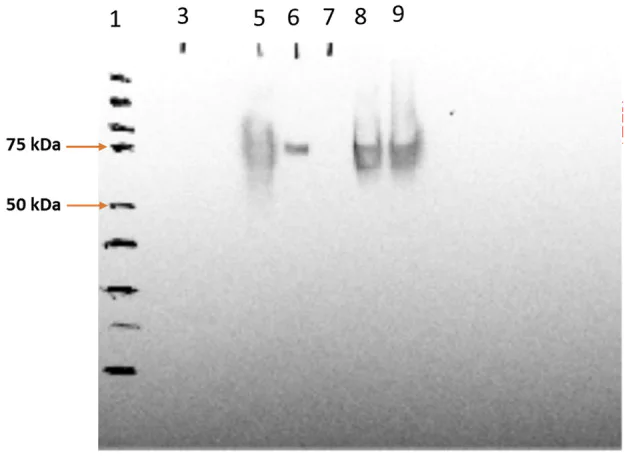 Western blot - Cy5® Conjugation Kit (Fast) - Lightning-Link® (AB188288)