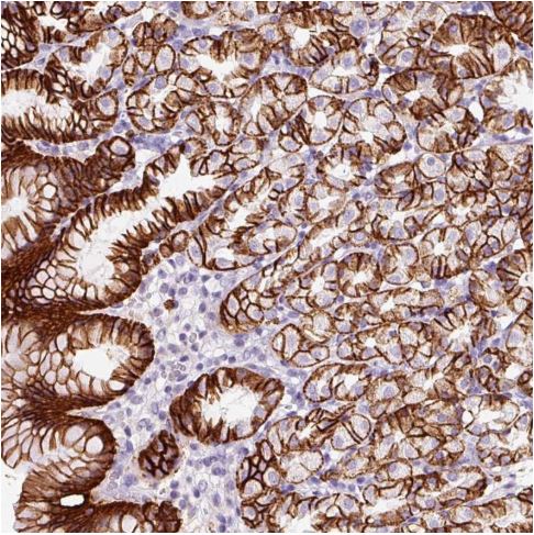 Immunohistochemistry (Formalin/PFA-fixed paraffin-embedded sections) - Anti-CYB561A3 antibody (AB185304)