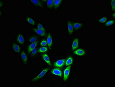 Immunocytochemistry/ Immunofluorescence - Anti-CYB5B antibody (AB236612), expandable thumbnail
