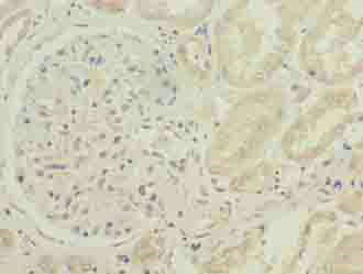 Immunohistochemistry (Formalin/PFA-fixed paraffin-embedded sections) - Anti-CYB5B antibody (AB236612), expandable thumbnail