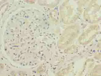 Immunohistochemistry (Formalin/PFA-fixed paraffin-embedded sections) - Anti-CYB5B antibody (AB236612)