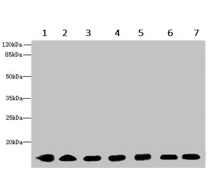 Western blot - Anti-CYB5B antibody (AB236612), expandable thumbnail