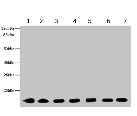Western blot - Anti-CYB5B antibody (AB236612)