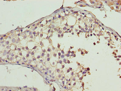 Immunohistochemistry (Formalin/PFA-fixed paraffin-embedded sections) - Anti-CYB5R2 antibody (AB237813)