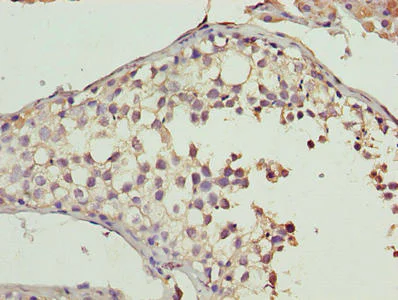 Immunohistochemistry (Formalin/PFA-fixed paraffin-embedded sections) - Anti-CYB5R2 antibody (AB237813)