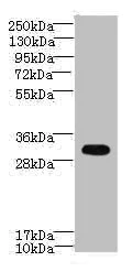 Western blot - Anti-CYB5R2 antibody (AB237813)
