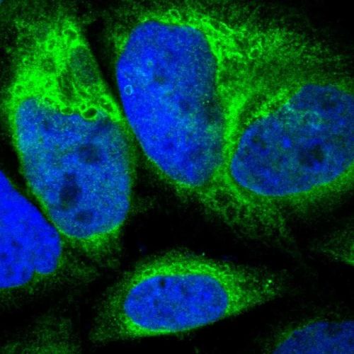 Immunocytochemistry/ Immunofluorescence - Anti-CYB5R3 antibody (AB244253)