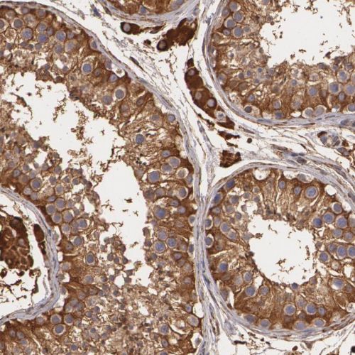 Immunohistochemistry (Formalin/PFA-fixed paraffin-embedded sections) - Anti-CYB5R3 antibody (AB244253)