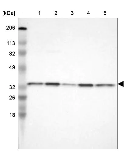 Western blot - Anti-CYB5R3 antibody (AB244253)