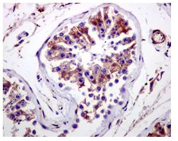 Immunohistochemistry (Formalin/PFA-fixed paraffin-embedded sections) - Anti-CYB5R3 antibody [EPR3867] (AB109620)