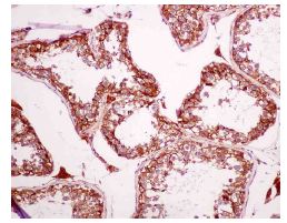 Immunohistochemistry (Formalin/PFA-fixed paraffin-embedded sections) - Anti-CYB5R3 antibody [EPR3868] - BSA and Azide free (AB248422), expandable thumbnail