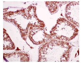 Immunohistochemistry (Formalin/PFA-fixed paraffin-embedded sections) - Anti-CYB5R3 antibody [EPR3868] - BSA and Azide free (AB248422)