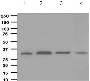 Western blot - Anti-CYB5R3 antibody [EPR3868] - BSA and Azide free (AB248422), expandable thumbnail