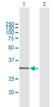 Western blot - Anti-CYC1 antibody (AB167568)
