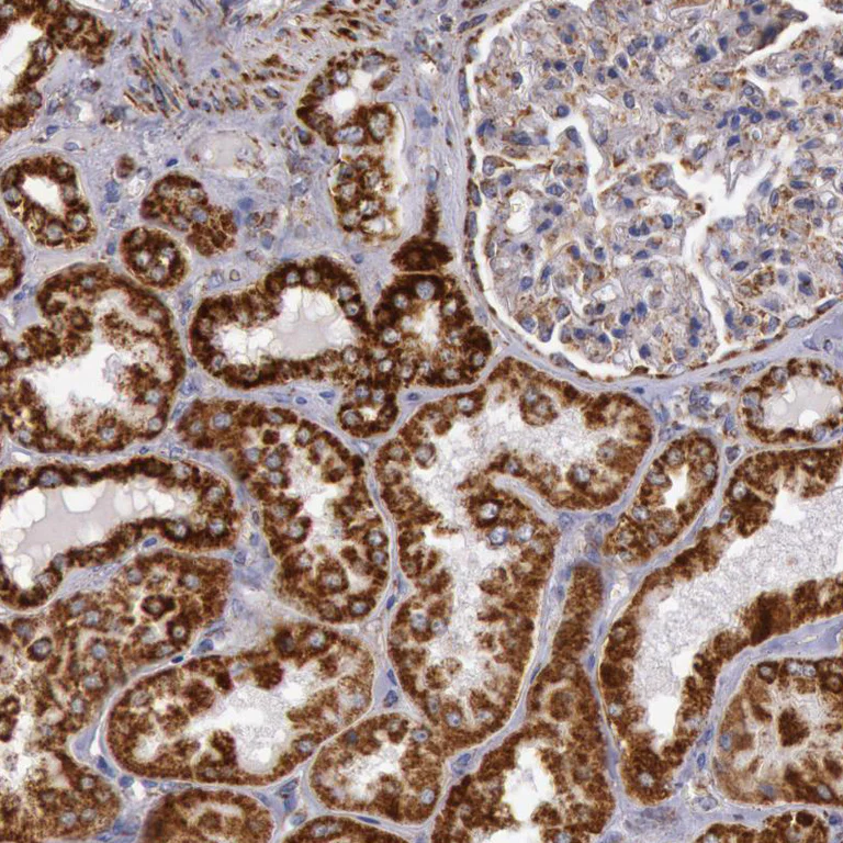 Immunohistochemistry (Formalin/PFA-fixed paraffin-embedded sections) - Anti-CYC1 antibody (AB224044)