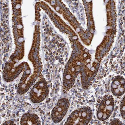 Immunohistochemistry (Formalin/PFA-fixed paraffin-embedded sections) - Anti-CYC1 antibody (AB224044)