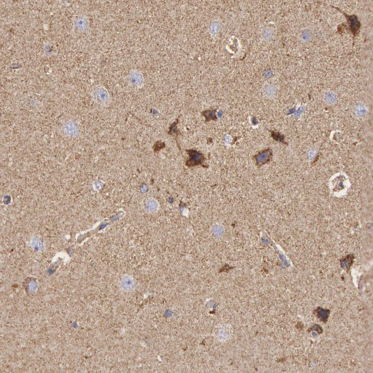 Immunohistochemistry (Formalin/PFA-fixed paraffin-embedded sections) - Anti-CYC1 antibody (AB224044)