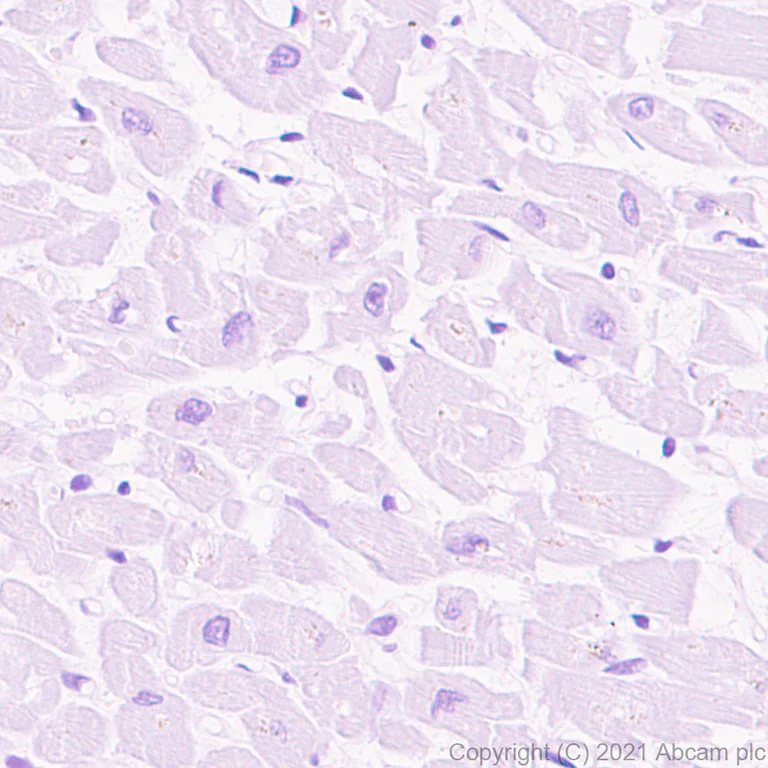 Immunohistochemistry (Formalin/PFA-fixed paraffin-embedded sections) - Anti-Cyclin A1 antibody [EPR24373-146] (AB270940)