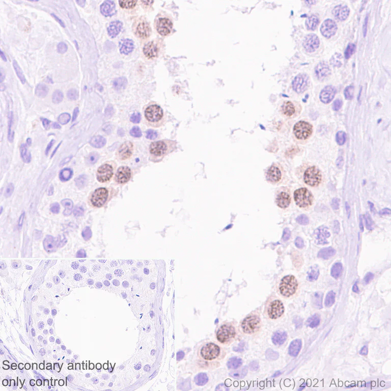Immunohistochemistry (Formalin/PFA-fixed paraffin-embedded sections) - Anti-Cyclin A1 antibody [EPR24373-146] (AB270940)