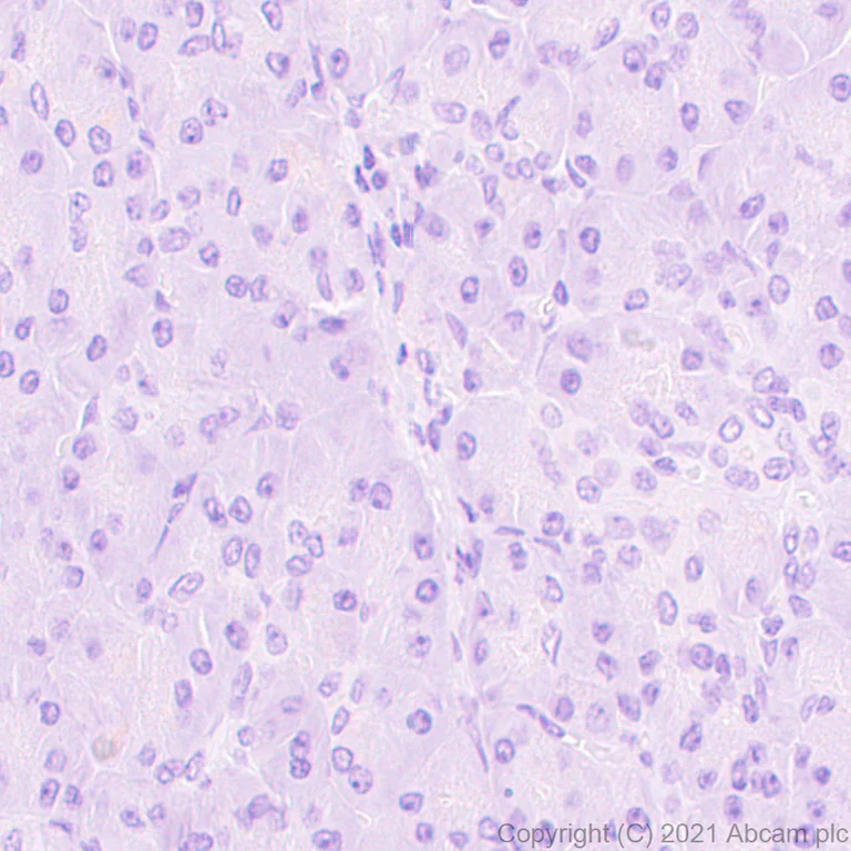 Immunohistochemistry (Formalin/PFA-fixed paraffin-embedded sections) - Anti-Cyclin A1 antibody [EPR24373-146] (AB270940)