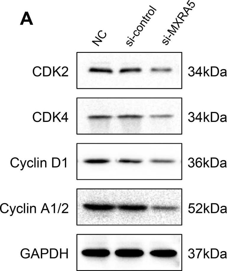 Western blot - Anti-Cyclin A1 + Cyclin A2 antibody [EPR18054] (AB185619)
