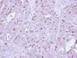 Immunohistochemistry (Formalin/PFA-fixed paraffin-embedded sections) - Anti-Cyclin A2 antibody (AB137769)