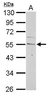 Western blot - Anti-Cyclin A2 antibody (AB137769)