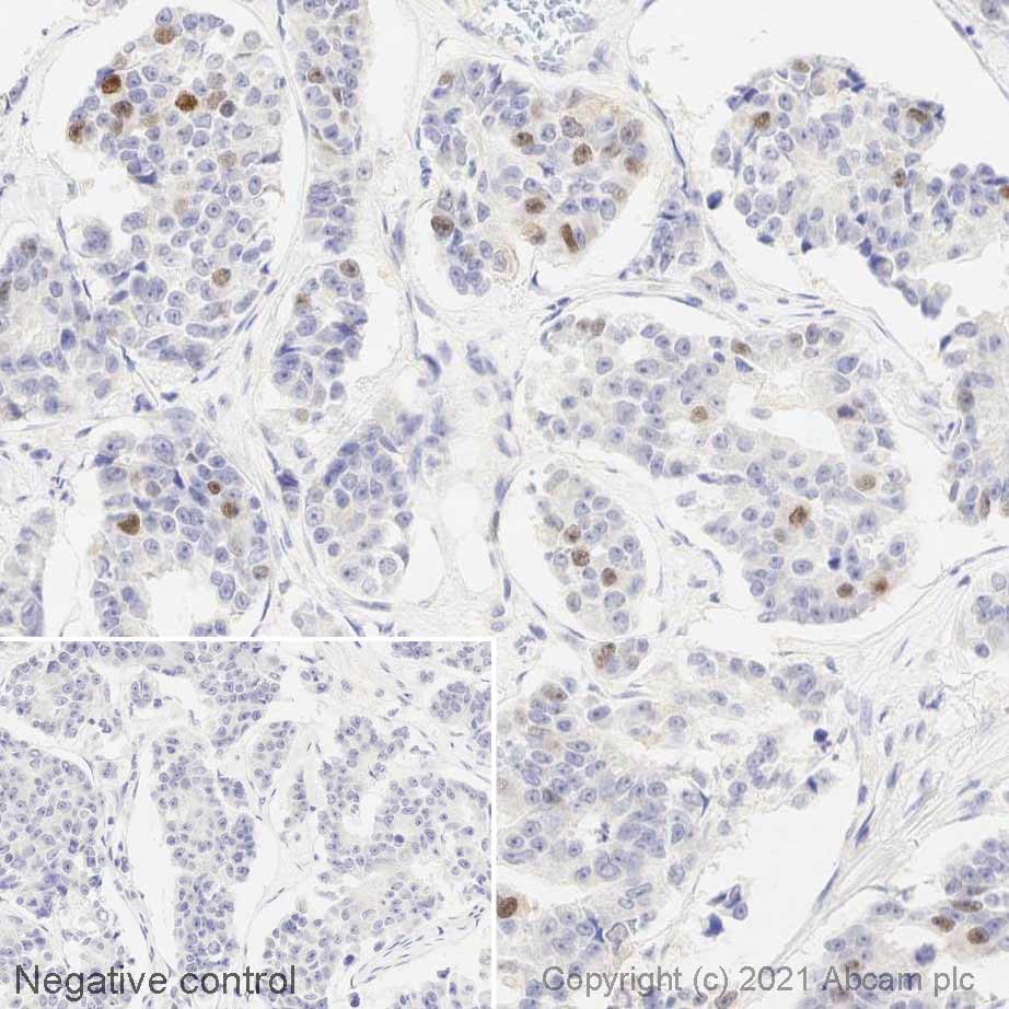 Immunohistochemistry (Formalin/PFA-fixed paraffin-embedded sections) - Anti-Cyclin A2 antibody [E23.1] (AB38)