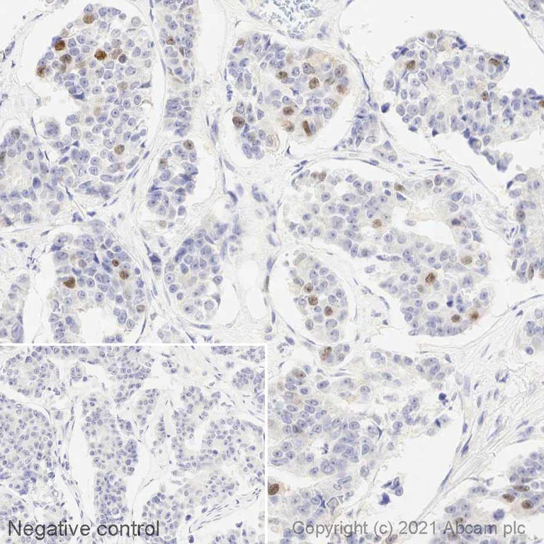 Immunohistochemistry (Formalin/PFA-fixed paraffin-embedded sections) - Anti-Cyclin A2 antibody [E23.1] (AB38)