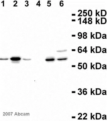 Western blot - Anti-Cyclin A2 antibody [E23.1] (AB38)