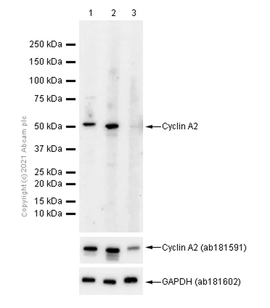 Western blot - Anti-Cyclin A2 antibody [E399] (AB32498)
