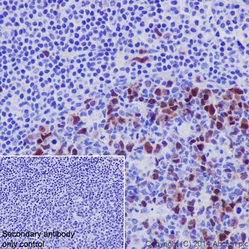 Immunohistochemistry (Formalin/PFA-fixed paraffin-embedded sections) - Anti-Cyclin A2 antibody [EPR17351] (AB181591)