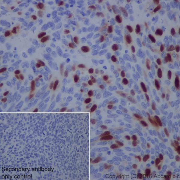 Immunohistochemistry (Formalin/PFA-fixed paraffin-embedded sections) - Anti-Cyclin A2 antibody [EPRR19346-64] (ab211735), expandable thumbnail