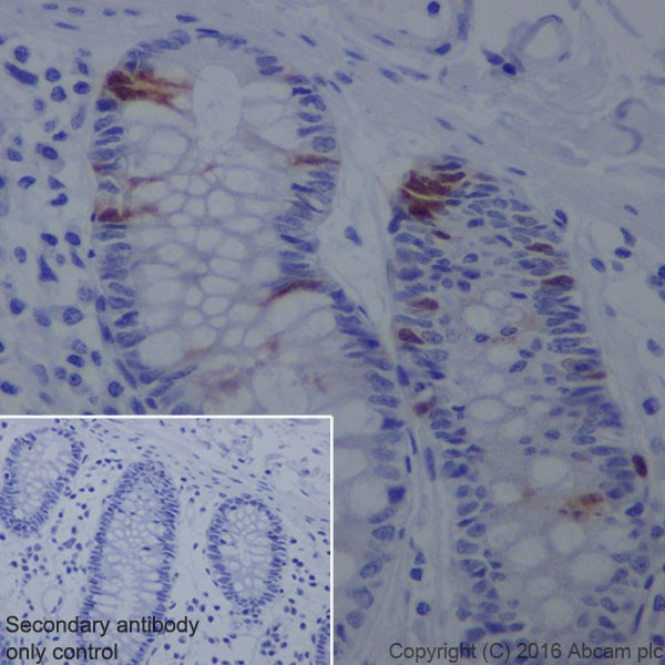 Immunohistochemistry (Formalin/PFA-fixed paraffin-embedded sections) - Anti-Cyclin A2 antibody [EPRR19346-64] (AB211735), expandable thumbnail