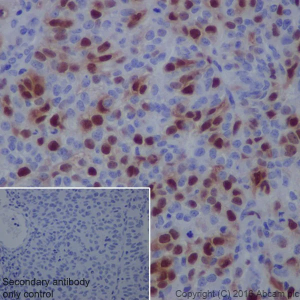 Immunohistochemistry (Formalin/PFA-fixed paraffin-embedded sections) - Anti-Cyclin A2 antibody [EPRR19346-64] - BSA and Azide free (AB251532)